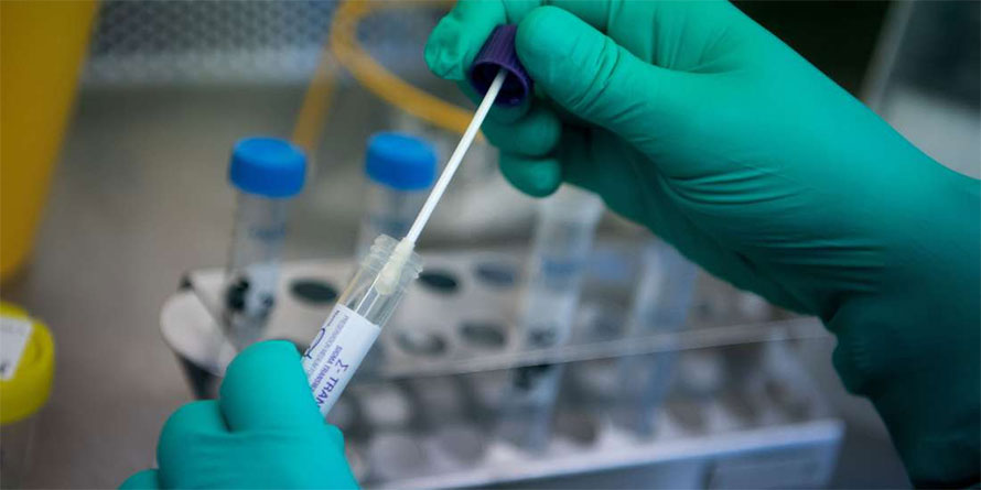 testing Novel Coronavirus