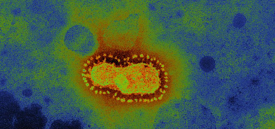 Coronavirus, Tem