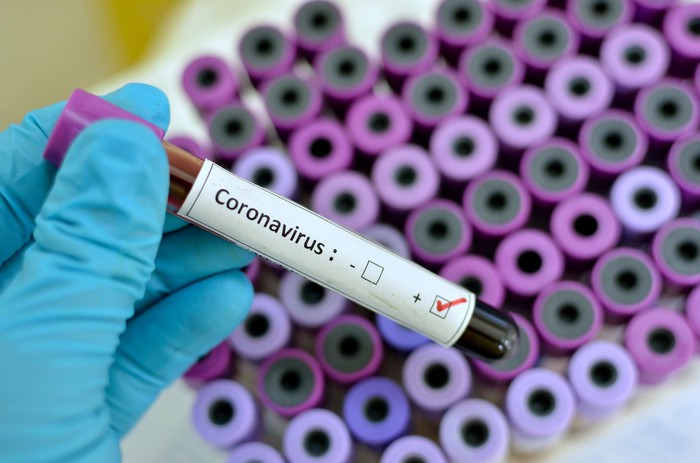 Gloved hand holding a blood vial with a label showing a check mark in a box indicating positive for coronavirus