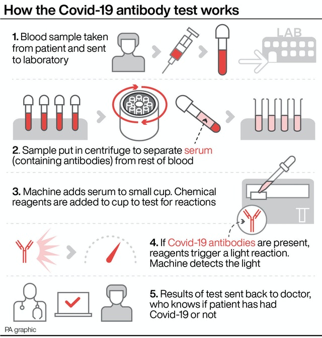 HEALTH Coronavirus Antibody QandA