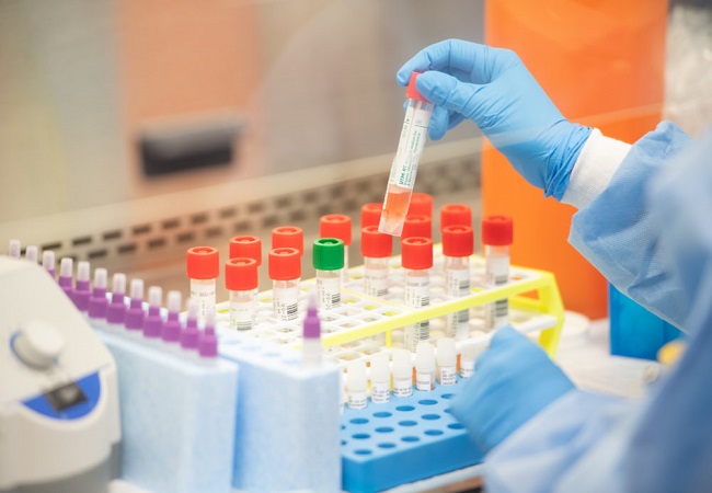 ICMR tells states to not use COVID-19 rapid testing kits for two days