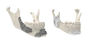 3d-systems-jaw-material-mockup-sls-and-titanium-300ppi
