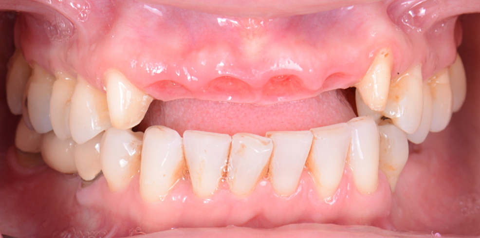 Final-architecture-of-the-soft-tissue.