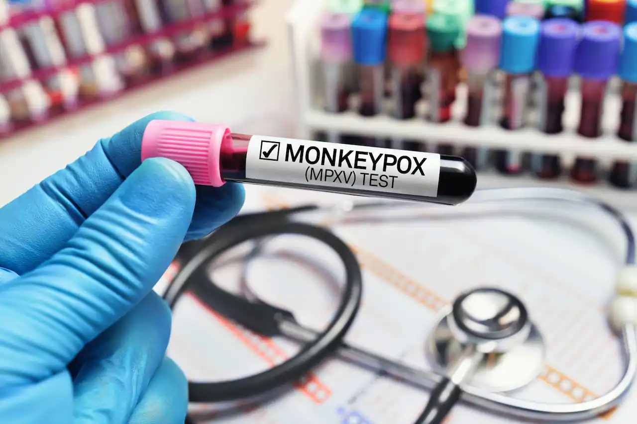 Hand with blue glove holding blood test tube labelled MONKEYPOX (MPXV) TEST