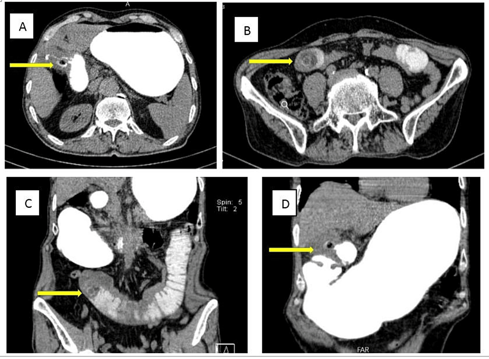 Oral-contrast-enhanced-CT---1 Oral-contrast-enhanced-CT---1