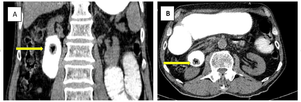 Oral-contrast-enhanced-CT---2 Oral-contrast-enhanced-CT---2
