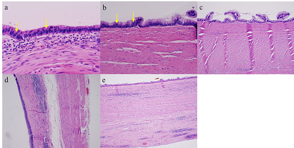 Pathology-from-Cases-1-to-5-(6a-e-respectively).-