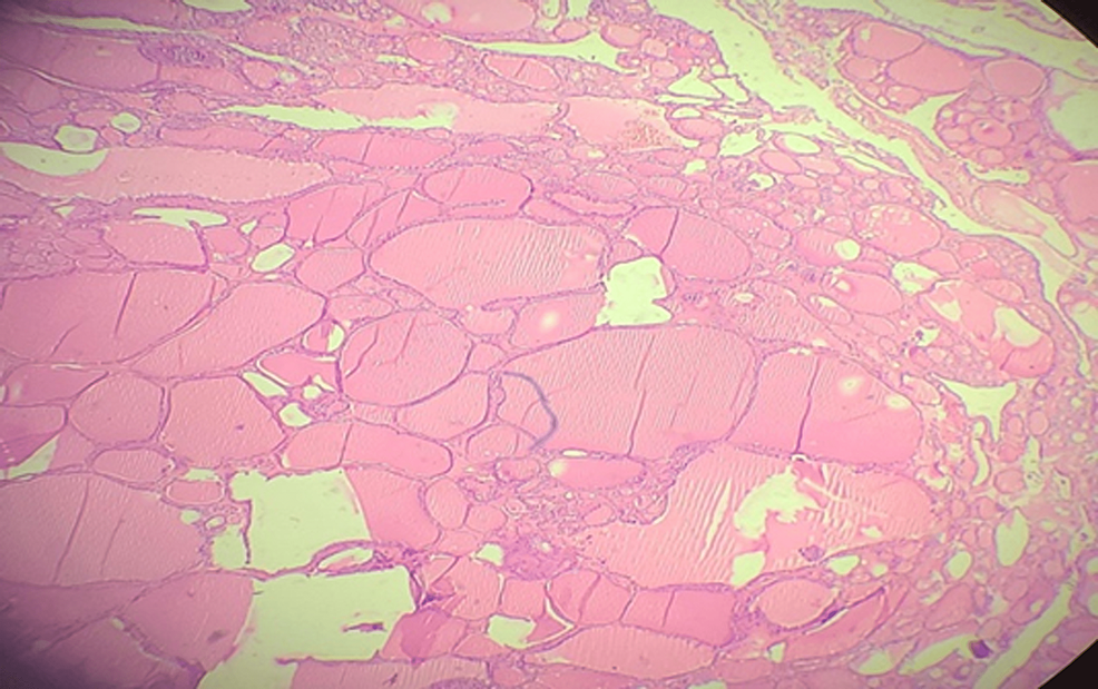 Biopsy-of-the-operative-specimen