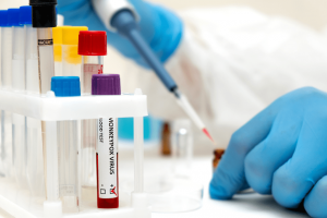 First case of monkey pox found in delaware