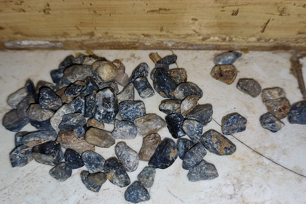 Image-showing-the-spontaneously-passed-lithobezoar.